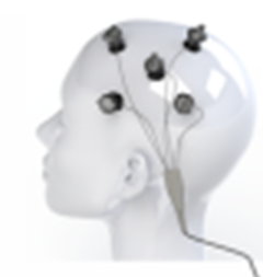 HD-tDCS image
